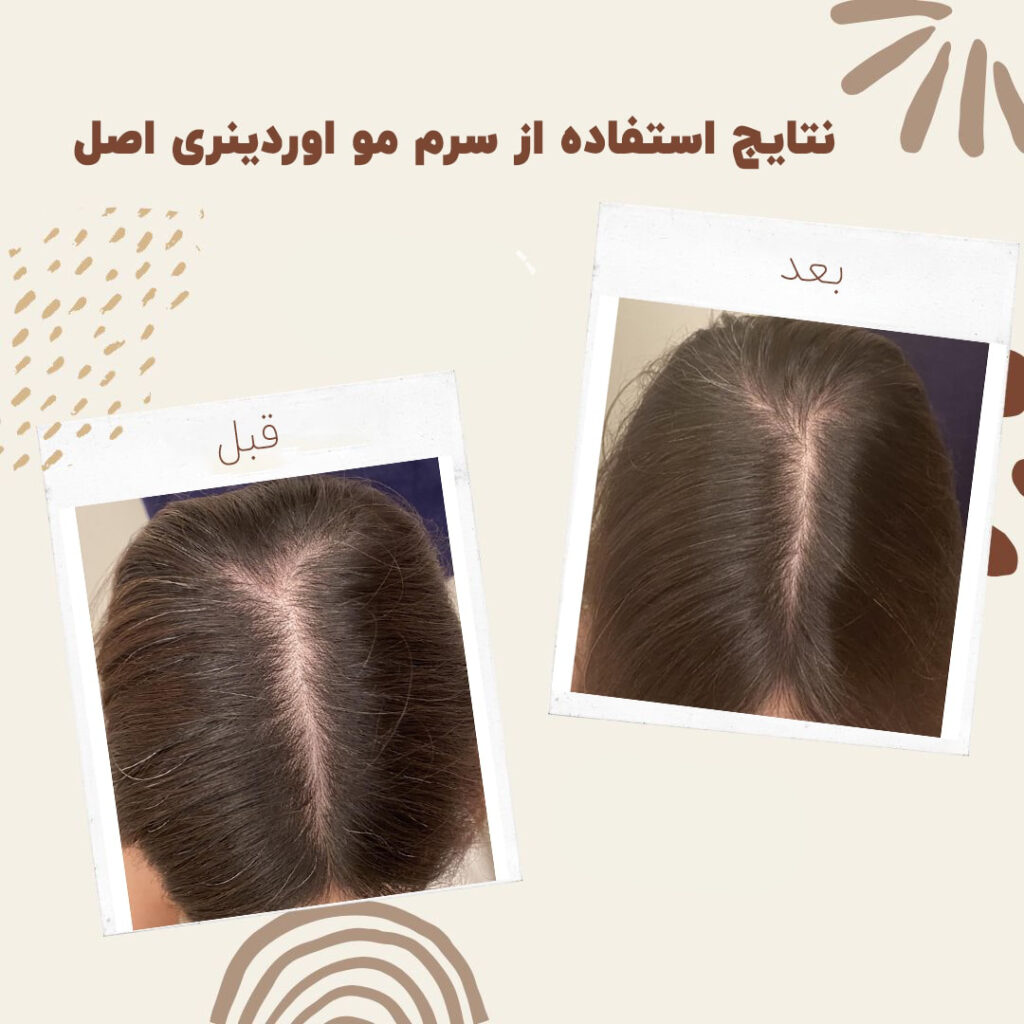 سرم مولتی پپتید مو اوردینریthe Ordinary Multi Peptide Serum for Hair Density