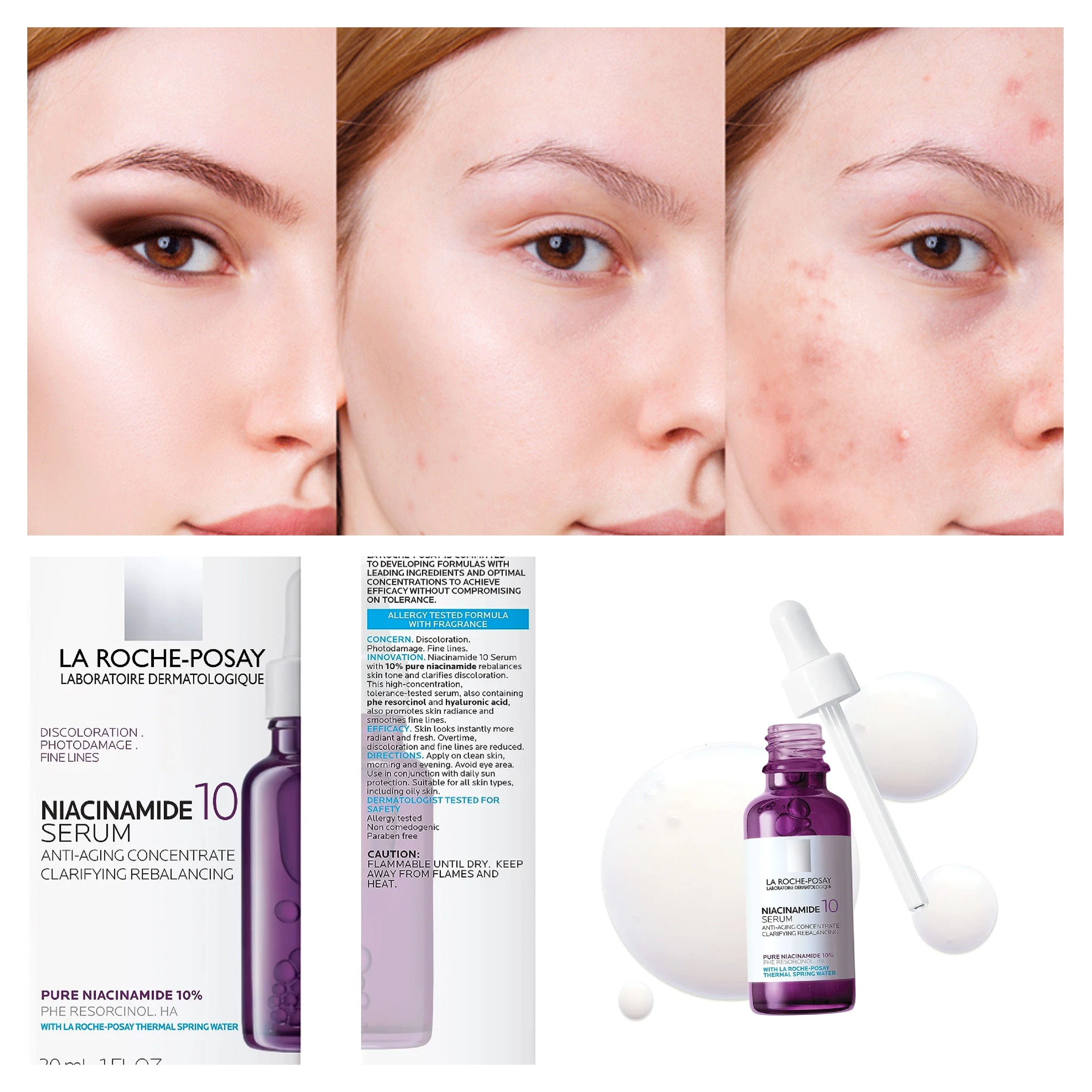 سرم ضدلک نیاسینامید  لاروش پوزای