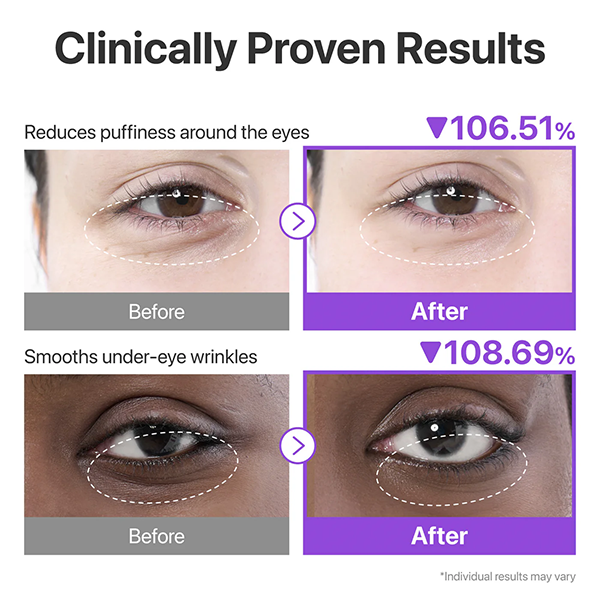 پچ کلاژن دورچشم نامبوزین 9